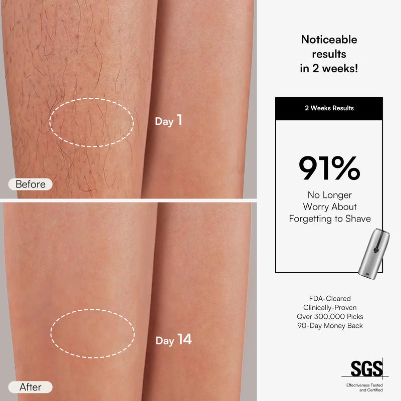 Nuvio IPL Hair Removal Device